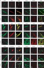 Rabbit IgG (H+L) Highly Cross-Adsorbed Secondary Antibody in Immunocytochemistry (ICC/IF)