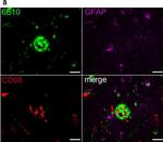 Rabbit IgG (H+L) Highly Cross-Adsorbed Secondary Antibody in Immunohistochemistry (IHC)