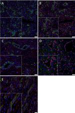 Rabbit IgG (H+L) Highly Cross-Adsorbed Secondary Antibody in Immunohistochemistry (Paraffin) (IHC (P))