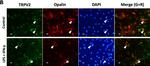 Rabbit IgG (H+L) Highly Cross-Adsorbed Secondary Antibody in Immunocytochemistry (ICC/IF)