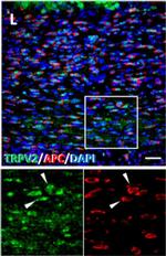 Rabbit IgG (H+L) Highly Cross-Adsorbed Secondary Antibody in Immunocytochemistry (ICC/IF)