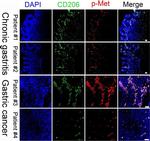 Rabbit IgG (H+L) Highly Cross-Adsorbed Secondary Antibody in Immunohistochemistry (Paraffin) (IHC (P))