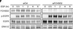 Rabbit IgG (H+L) Cross-Adsorbed Secondary Antibody in Western Blot (WB)