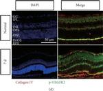 Mouse IgG (H+L) Cross-Adsorbed Secondary Antibody in Immunohistochemistry (IHC)