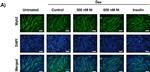 Mouse IgG (H+L) Cross-Adsorbed Secondary Antibody in Immunocytochemistry (ICC/IF)