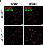 Rabbit IgG (H+L) Cross-Adsorbed Secondary Antibody in Immunocytochemistry (ICC/IF)