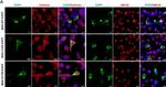 Rabbit IgG (H+L) Cross-Adsorbed Secondary Antibody in Immunocytochemistry (ICC/IF)