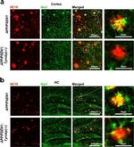 Mouse IgG (H+L) Cross-Adsorbed Secondary Antibody in Immunohistochemistry (IHC)