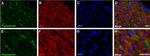 Mouse IgG (H+L) Cross-Adsorbed Secondary Antibody in Immunohistochemistry (Paraffin) (IHC (P))