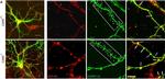 Rabbit IgG (H+L) Highly Cross-Adsorbed Secondary Antibody in Immunocytochemistry (ICC/IF)