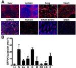 Endomucin Antibody in Immunohistochemistry (IHC)