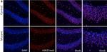 Rabbit IgG (H+L) Cross-Adsorbed Secondary Antibody in Immunohistochemistry (Paraffin) (IHC (P))