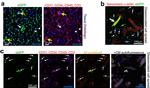 CD34 Antibody in Immunohistochemistry (IHC)