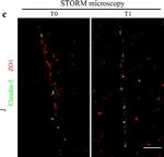 Rabbit IgG (H+L) Cross-Adsorbed Secondary Antibody in Immunohistochemistry (IHC)