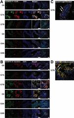 Rabbit IgG (H+L) Cross-Adsorbed Secondary Antibody in Immunohistochemistry (Paraffin) (IHC (P))