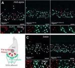 Rabbit IgG (H+L) Highly Cross-Adsorbed Secondary Antibody in Immunohistochemistry (IHC)