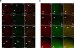 Rabbit IgG (H+L) Highly Cross-Adsorbed Secondary Antibody in Immunohistochemistry (IHC)