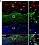 Sheep IgG (H+L) Cross-Adsorbed Secondary Antibody in Immunohistochemistry (IHC)