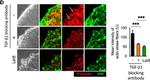 Mouse IgG (H+L) Highly Cross-Adsorbed Secondary Antibody in Immunocytochemistry (ICC/IF)