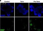 Rabbit IgG (H+L) Highly Cross-Adsorbed Secondary Antibody in Immunocytochemistry (ICC/IF)