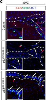 Rabbit IgG (H+L) Highly Cross-Adsorbed Secondary Antibody in Immunohistochemistry (IHC)