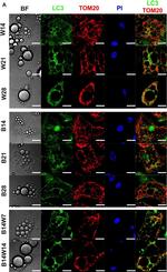 Rabbit IgG (H+L) Highly Cross-Adsorbed Secondary Antibody in Immunocytochemistry (ICC/IF)