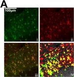 Rabbit IgG (H+L) Highly Cross-Adsorbed Secondary Antibody in Immunocytochemistry (ICC/IF)