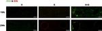 Rabbit IgG (H+L) Highly Cross-Adsorbed Secondary Antibody in Immunocytochemistry (ICC/IF)