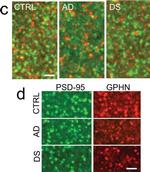 Rabbit IgG (H+L) Highly Cross-Adsorbed Secondary Antibody in Immunohistochemistry (IHC)