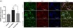 Rabbit IgG (H+L) Highly Cross-Adsorbed Secondary Antibody in Immunocytochemistry (ICC/IF)