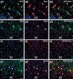 Rabbit IgG (Heavy chain) Secondary Antibody in Immunohistochemistry (IHC)