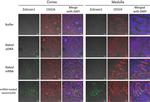 Rabbit IgG (H+L) Cross-Adsorbed Secondary Antibody in Immunohistochemistry (IHC)