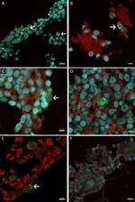 Mouse IgG (H+L) Highly Cross-Adsorbed Secondary Antibody in Immunocytochemistry (ICC/IF)