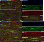 Mouse IgG (H+L) Highly Cross-Adsorbed Secondary Antibody in Immunohistochemistry (IHC)