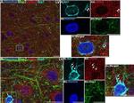 Mouse IgG (H+L) Highly Cross-Adsorbed Secondary Antibody in Immunohistochemistry (IHC)