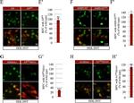 Rabbit IgG (H+L) Highly Cross-Adsorbed Secondary Antibody in Immunocytochemistry (ICC/IF)