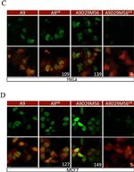 Rabbit IgG (H+L) Highly Cross-Adsorbed Secondary Antibody in Immunocytochemistry (ICC/IF)