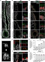 FOXJ1 Antibody in Immunohistochemistry (IHC)