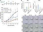 FOXP3 Antibody in Immunohistochemistry (IHC)