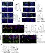 FOXJ1 Antibody in Immunocytochemistry (ICC/IF)