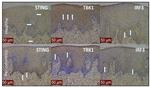 TBK1 Antibody in Immunohistochemistry (IHC)