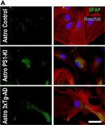 Rabbit IgG (H+L) Cross-Adsorbed Secondary Antibody in Immunocytochemistry (ICC/IF)