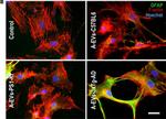 Mouse IgG (H+L) Cross-Adsorbed Secondary Antibody in Immunocytochemistry (ICC/IF)