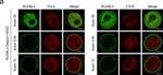 Rabbit IgG (H+L) Cross-Adsorbed Secondary Antibody in Immunocytochemistry (ICC/IF)