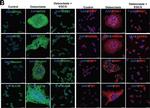 Mouse IgG (H+L) Cross-Adsorbed Secondary Antibody in Immunocytochemistry (ICC/IF)