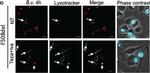 Rabbit IgG (H+L) Cross-Adsorbed Secondary Antibody in Immunocytochemistry (ICC/IF)