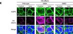 Rabbit IgG (H+L) Cross-Adsorbed Secondary Antibody in Immunocytochemistry (ICC/IF)