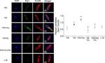 Rabbit IgG (H+L) Cross-Adsorbed Secondary Antibody in Immunocytochemistry (ICC/IF)