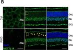 Rabbit IgG (H+L) Cross-Adsorbed Secondary Antibody in Immunocytochemistry (ICC/IF)