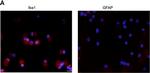 Rabbit IgG (H+L) Cross-Adsorbed Secondary Antibody in Immunocytochemistry (ICC/IF)